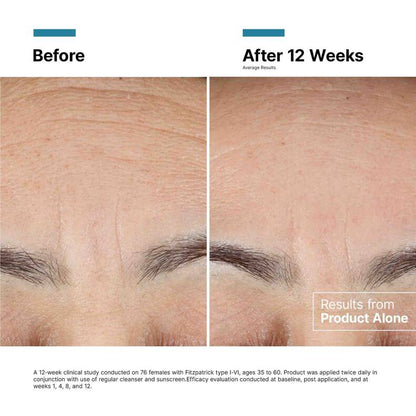 SkinCeuticals Advanced RGN-6 50ml - Crema Anti-Edad Post-Láser